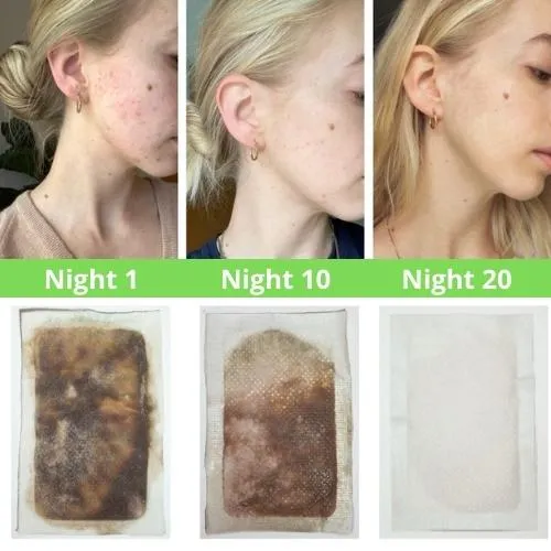 Himitsu Detox Foot Patches 12